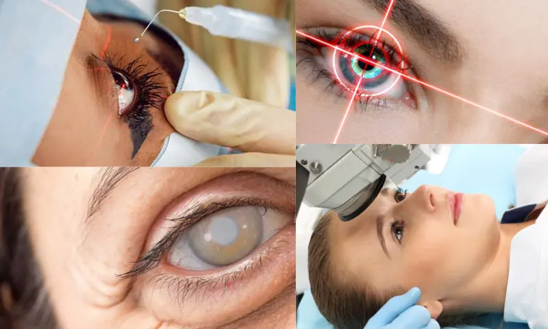 Katarakt Ameliyatı ile İlgili Lens Seçenekleri Nelerdir?
