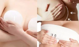 Meme Büyütme Ameliyatında Hangi Yöntemler Kullanılır?