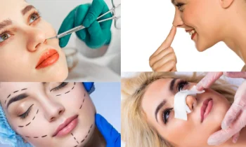 Rinoplasti - Rhinoplasty Nedir ve Nerede Yaptırılır?