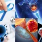 Prostat Kanseri Belirtileri Nelerdir?